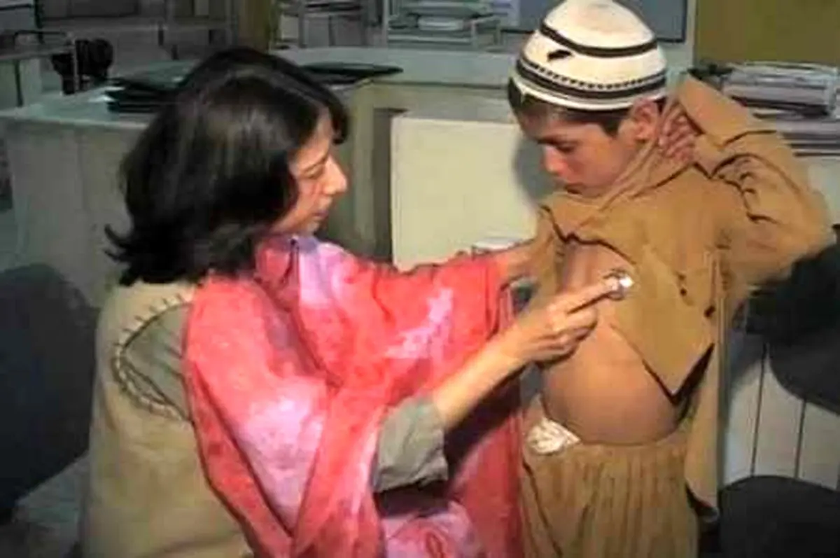 'كودكان خورشیدی'،بیماری ناشناخته درپاكستان