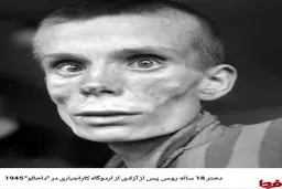 دختر 18ساله روس پس از آزادی از اردوگاه کار اجباری/عکس