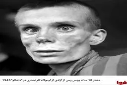 دختر 18ساله روس پس از آزادی از اردوگاه کار اجباری/عکس