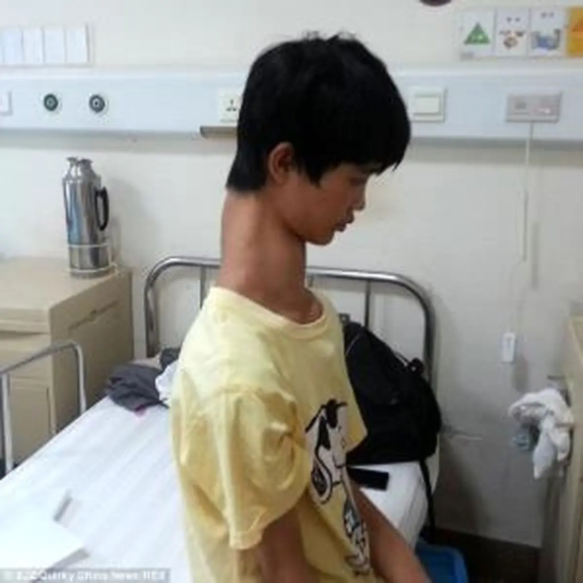 نوجوان چینی با گردن دراز+عكس