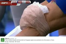 رونالدو دوباره مصدوم شد؟ (عکس)