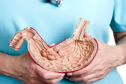 این نکات را قبل از عمل اسلیو باید بدانید
