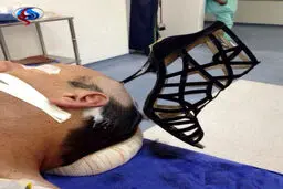 پاشنه کفش زن در سر شوهر جا ماند!/عکس