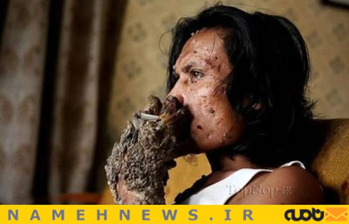 این مرد نیمی از بدنش درخت است!+تصاویر