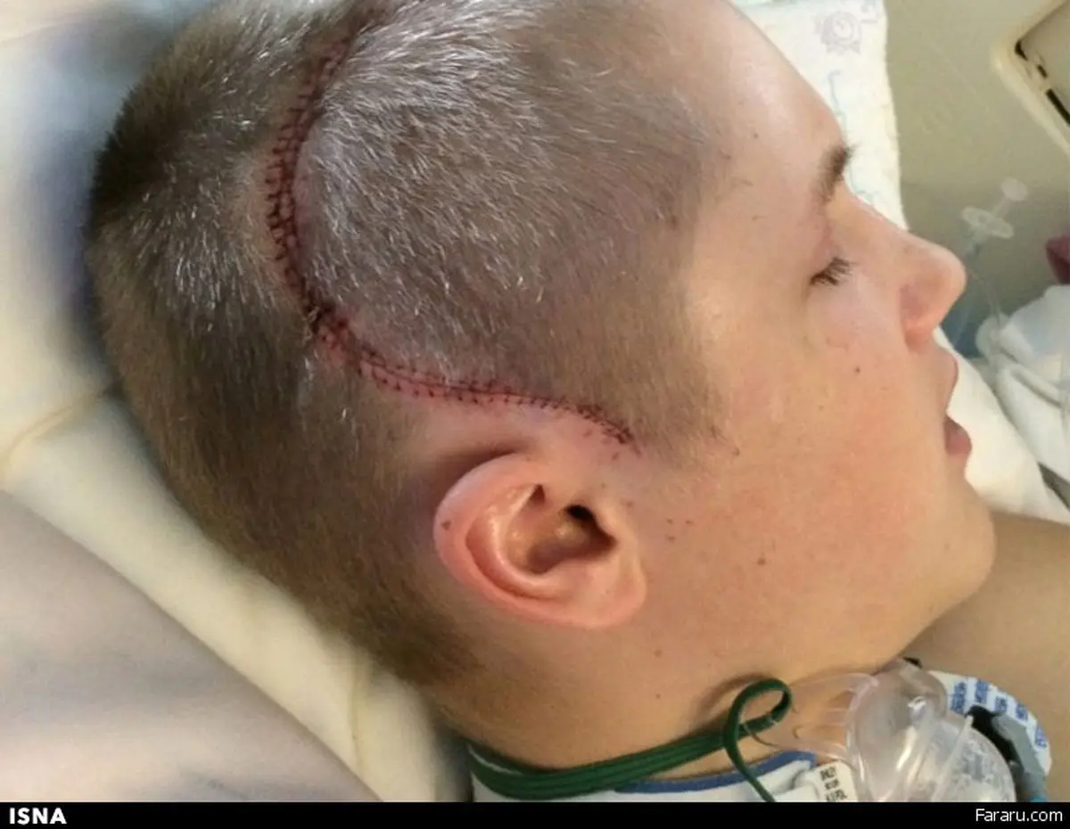 نوجوانی که «معجزه» را تجربه کرد + تصاویر