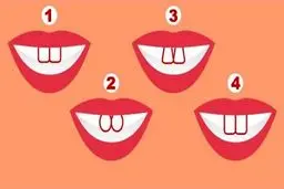 شخصیت شناسی از طریق شکل دندا‌ن‌ها + عکس