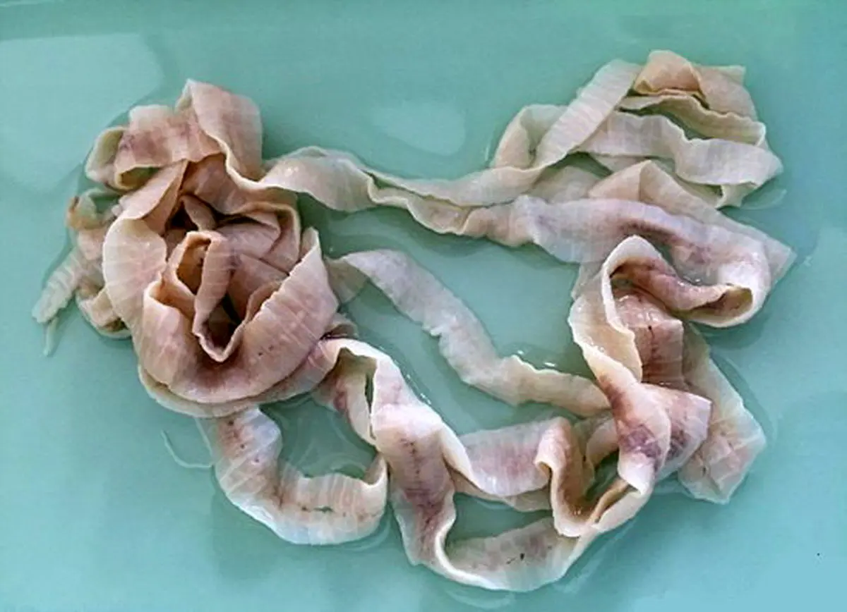 وحشتناک‌ترین راهکارها برای لاغری