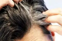 چگونه از سفیدشدن موها جلوگیری کنیم؟