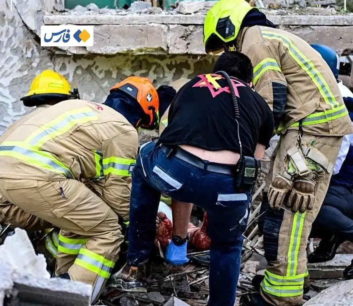 افزایش شمار مجروحان صهیونیست به بیش از ۱۷۰ نفر 