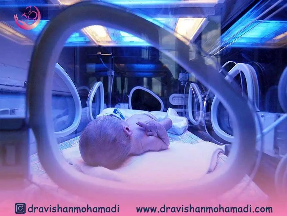 بهترین درمان های خانگی زردی نوزاد
