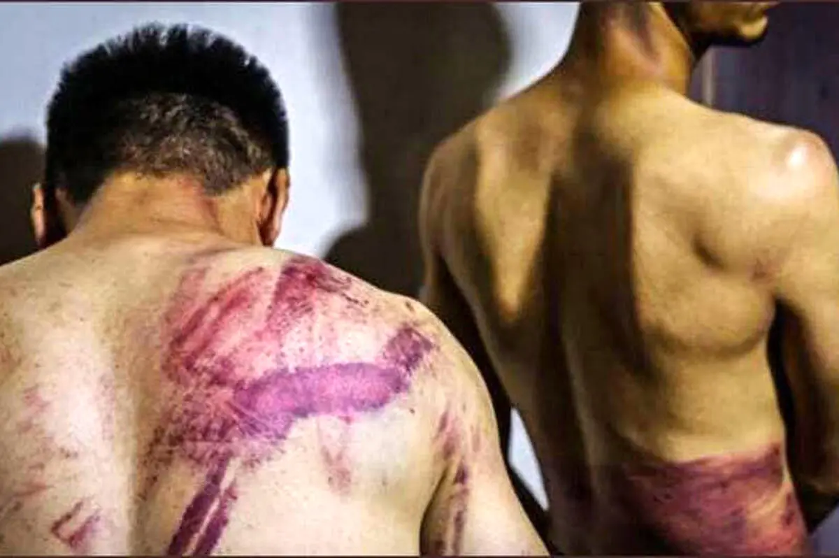 عکس تنبه و شکنجه خبرنگاران بازداشتی در کابل