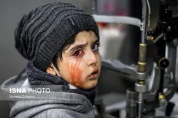 تصاویر دلخراش مصدومان چهارشنبه‌سوری ۱۴۰۲