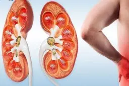 با این میوه تابستانی به جنگ سنگ کلیه بروید