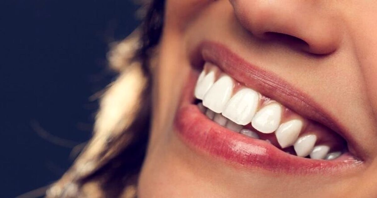 ارزان ترین روش ها برای سفید کردن دندانها