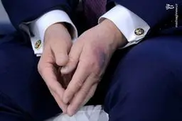 ترامپ تحت آزمایشات عروقی +عکس