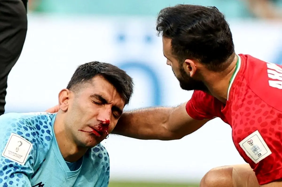 امید در اردوی پرسپولیس/ بیرانوند یک‌شنبه تست می‌دهد