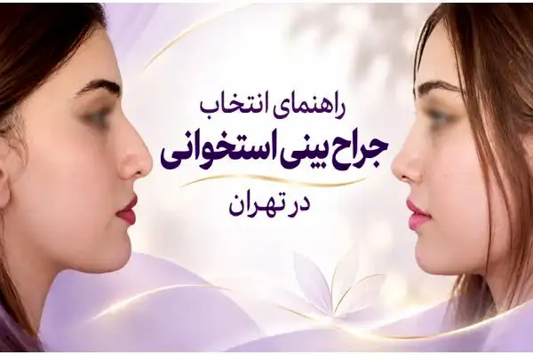 قوز بینی‌ام برداشته شود، چهره‌ام چقدر عوض می‌شود؟ راهنمای انتخاب جراح بینی استخوانی در تهران