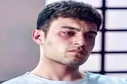 نظر میثم زخم کاری در باره ی سانسورها