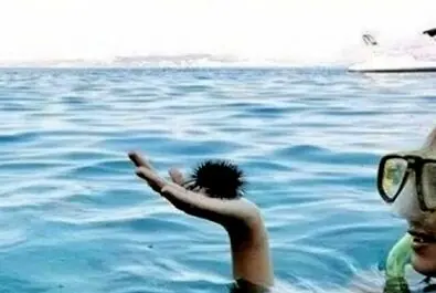 خطای دید