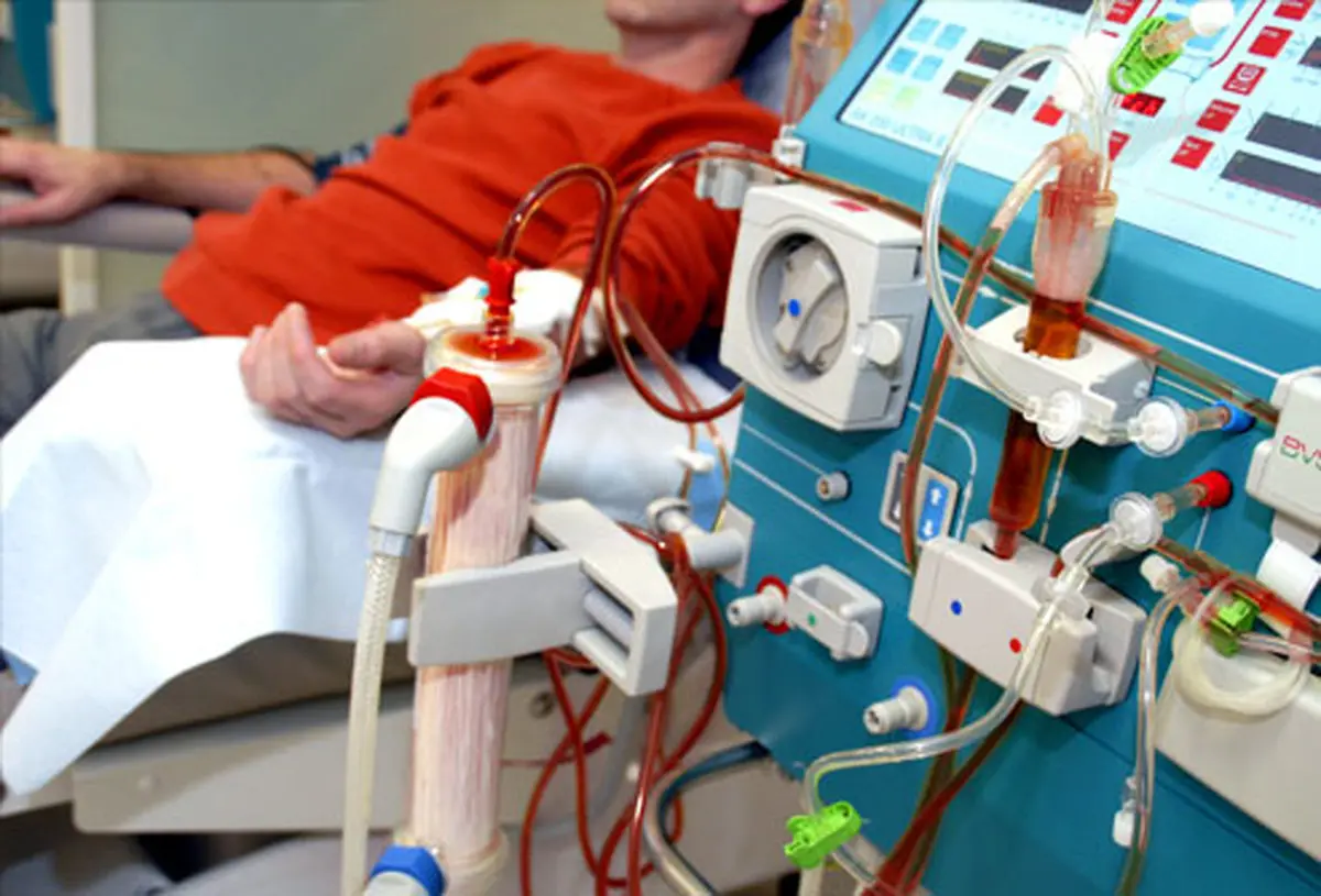دیالیز در منزل