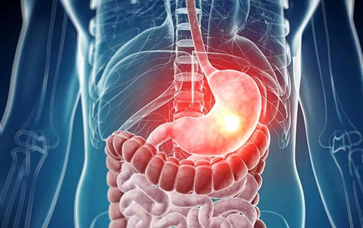 15 راهکار خانگی ساده برای سم زدایی روده بزرگ
