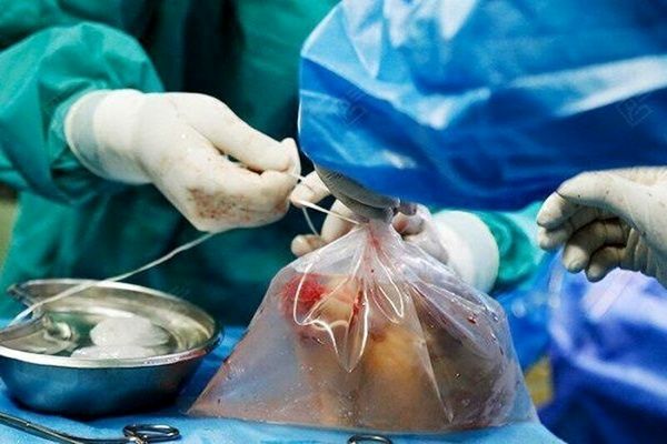 سرقت اعضای بدن شهدای فلسطینی توسط اسرائیل! + ویدئوی هولناک
