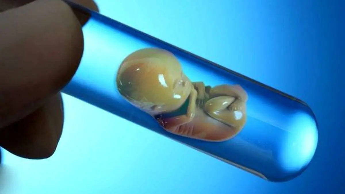در ivf جنین فریز شده بهتر است یا جنین تازه؟
