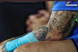 تتوی منشوری روی دست بازیکن استقلال!+عکس