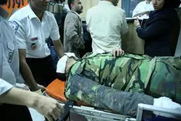 پرتاب نارنجک به صورت مامور پلیس در شرق تهران+عکس