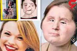 حادثه وحشتناک برای صورت این زن زیبا + عکس