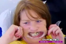 چسب‌کاری دندانها بخاطر ترس از دندانپزشک/عکس