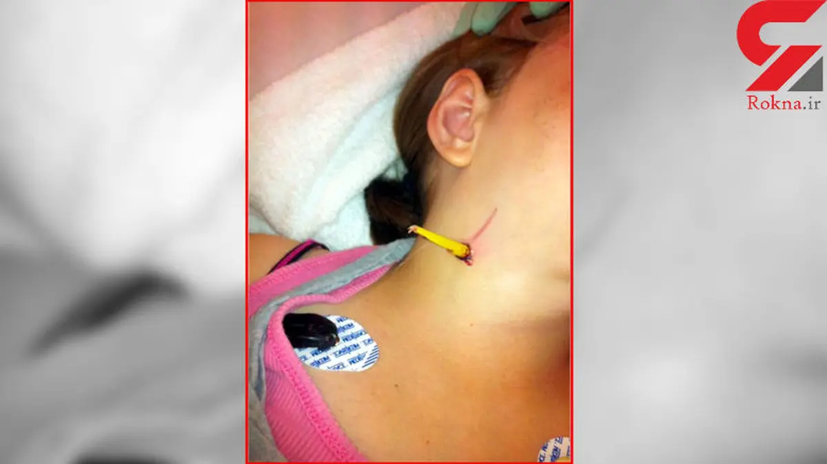 مداد گلوی دختری را شکافت! + عکس
