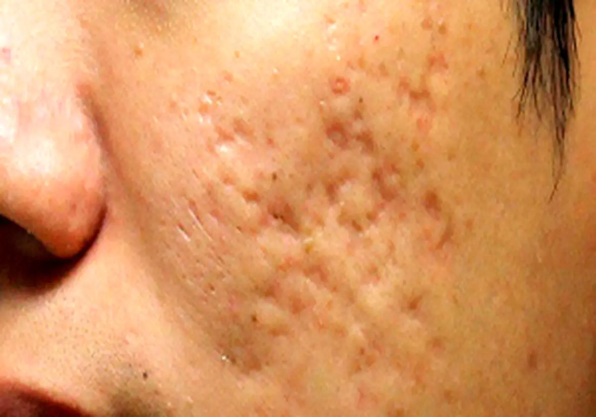 تاثیر مکمل های ورزشی بر پوست صورت چیست؟