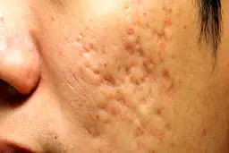 تاثیر مکمل های ورزشی بر پوست صورت چیست؟