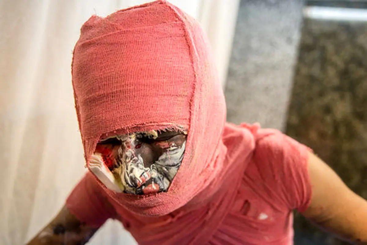 اولین خسارت چهارشنبه سوری امسال