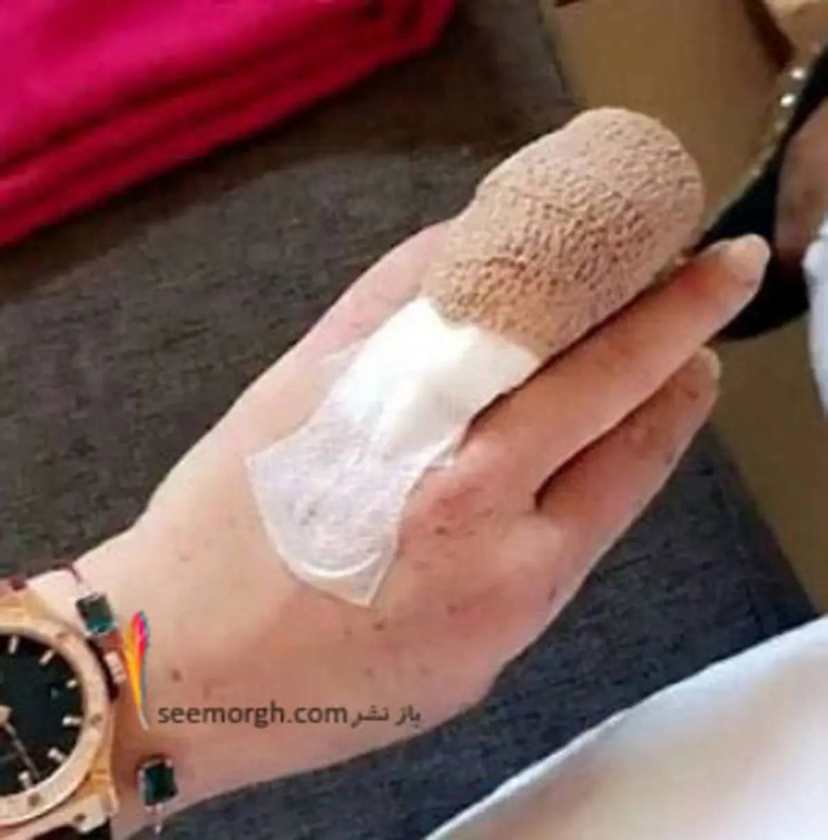 انگشت دست بازیگر زن هالیوودی قطع شد! عکس