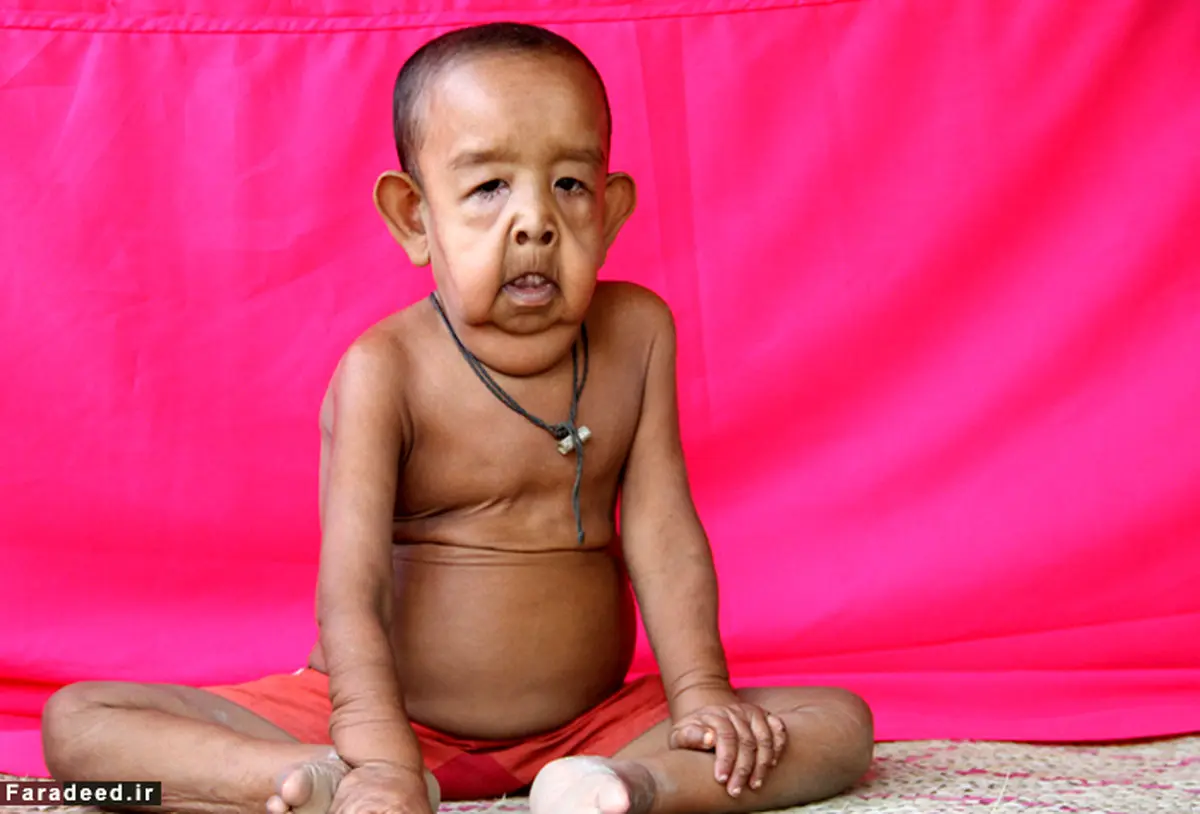 پیرمرد 4 ساله‌ای به نام بایزید! / تصاویر