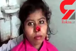شوهر وحشی با دندان دماغ لیلا را کند! + عکس عجیب
