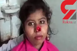 شوهر وحشی با دندان دماغ لیلا را کند! + عکس عجیب