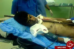 کارگری که با میله در گردن به صورت معجزه آسایی زنده ماند+عکس +18
