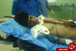 کارگری که با میله در گردن به صورت معجزه آسایی زنده ماند+عکس +18