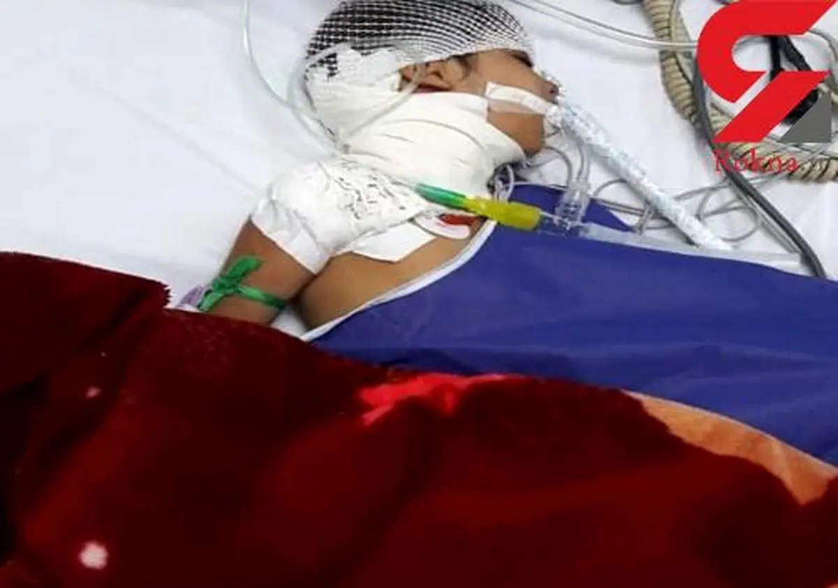 بلای وحشتناکی که 2 سگ وحشی بر سر دختر بچه خرمشهری آوردند+ عکس