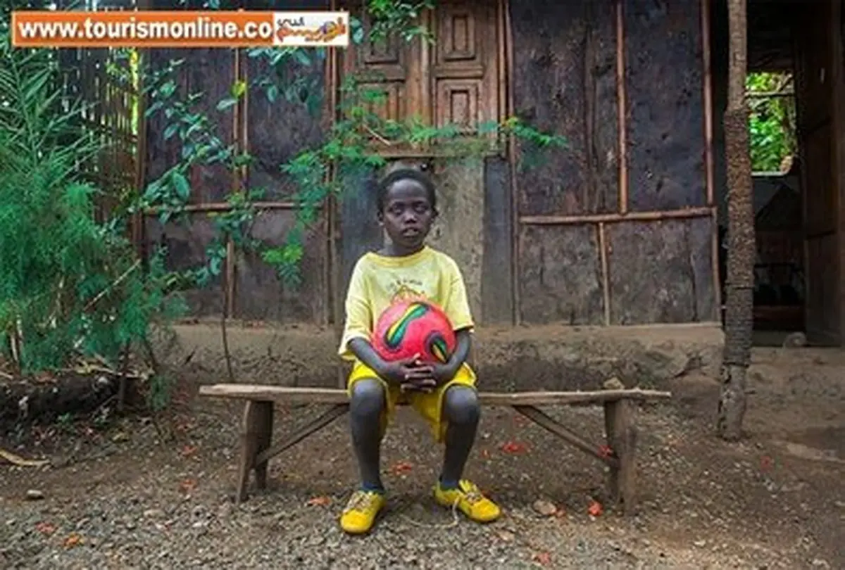 چشمان عجیب این پسر توجه عکاسان را به خود جلب کرد/تصاویر