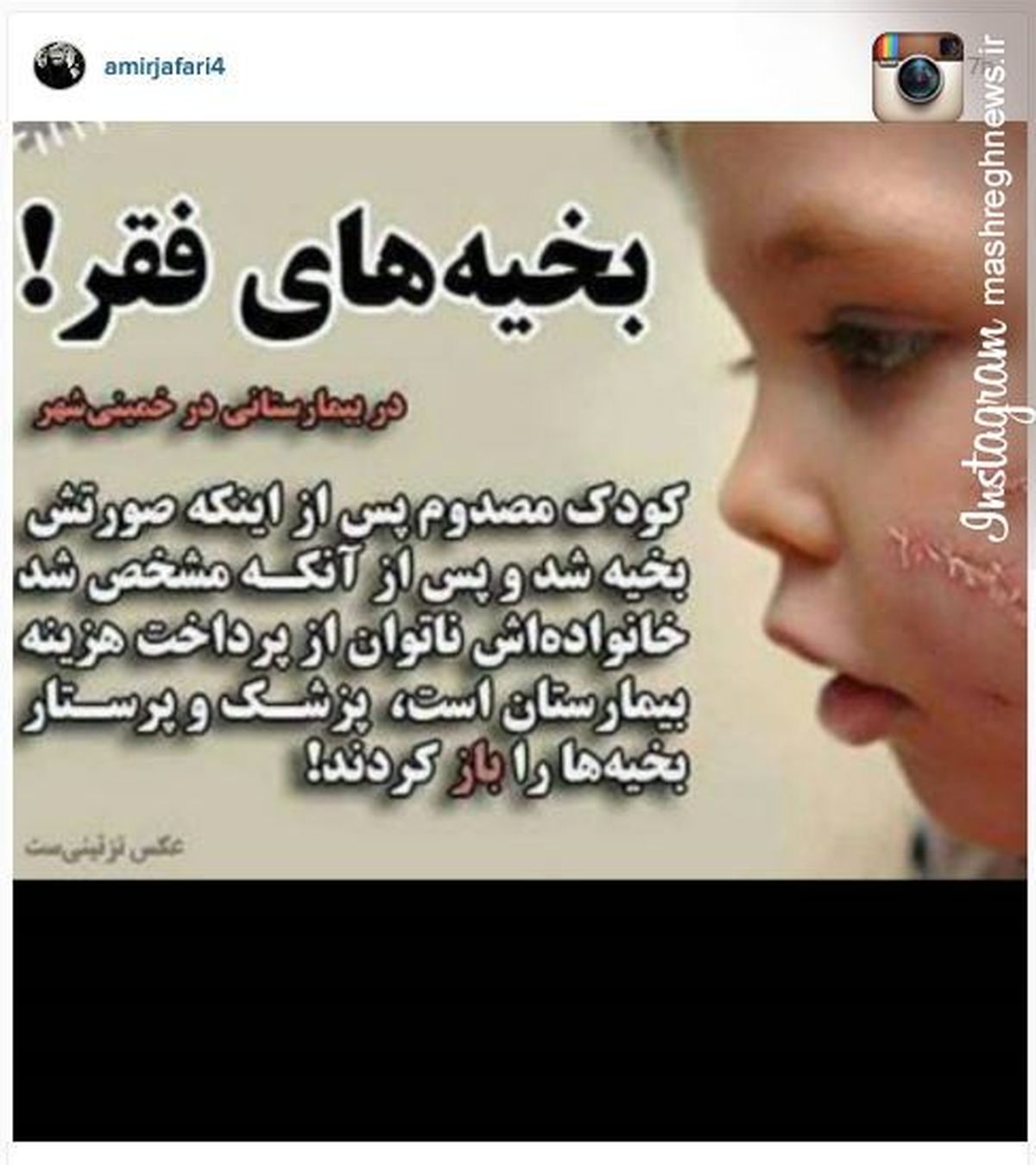 عکس/ بخیههای فقر در اینستاگرام امیر جعفری