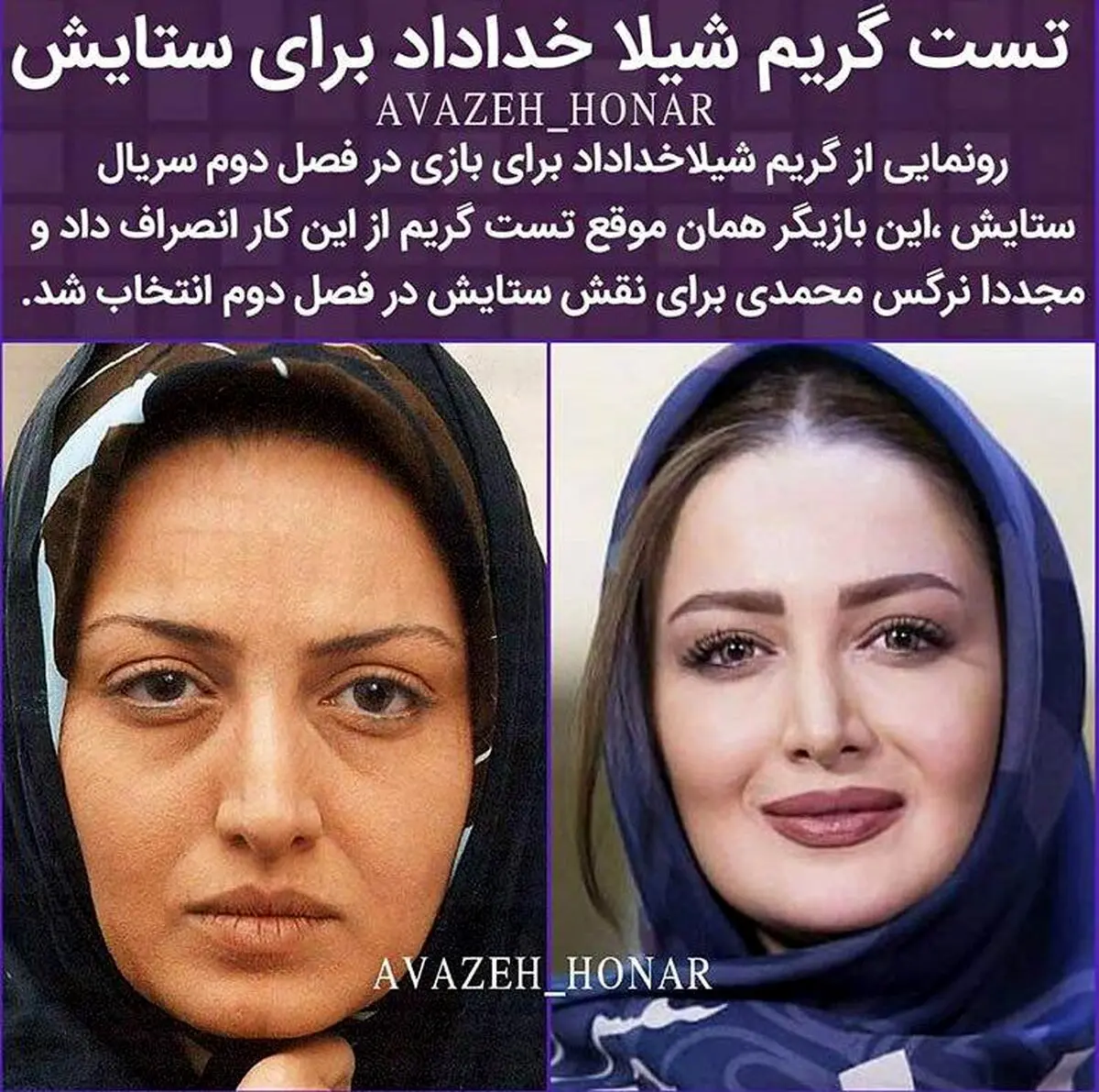 بازیگر زن معروف به یکباره پیر شد /عکس