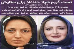 بازیگر زن معروف به یکباره پیر شد /عکس