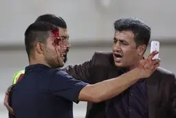 هواداری که سرش شکست اما سلفی‌اش را با رامین گرفت!