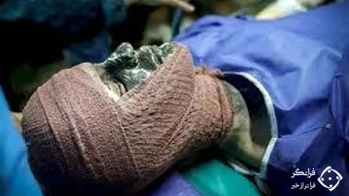 سوختگی شدید زن و بچه در آتش سوزی مشکوک بوکان + عکس 16+