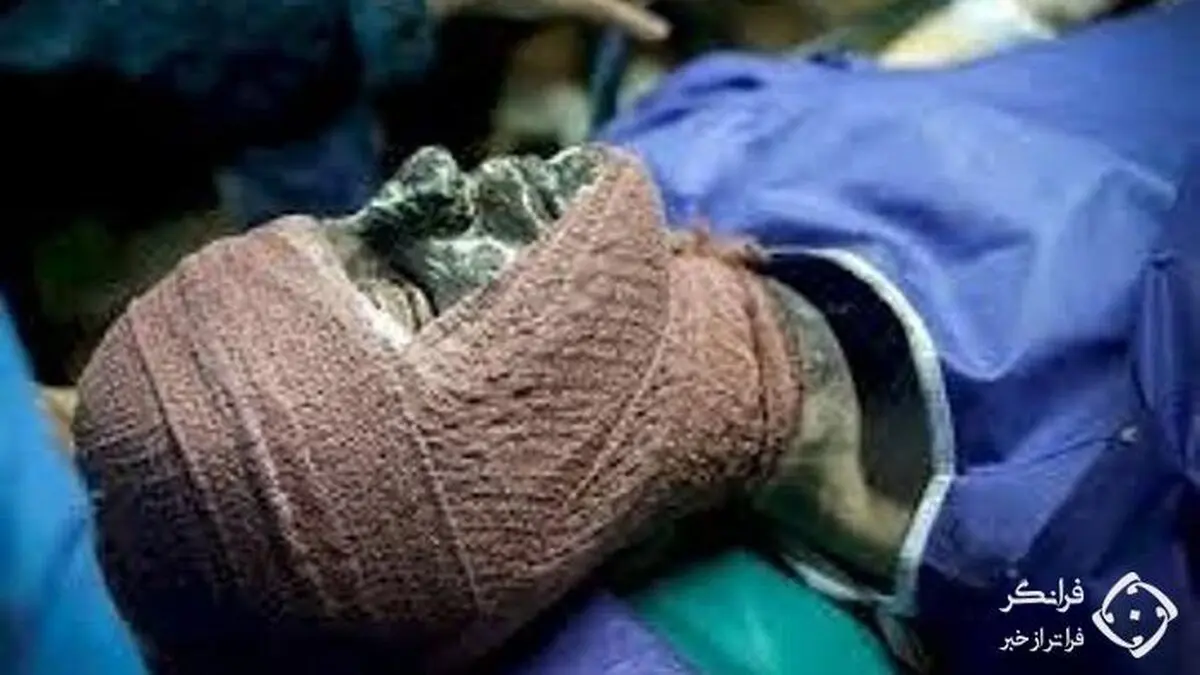 سوختگی شدید زن و بچه در آتش سوزی مشکوک بوکان + عکس 16+