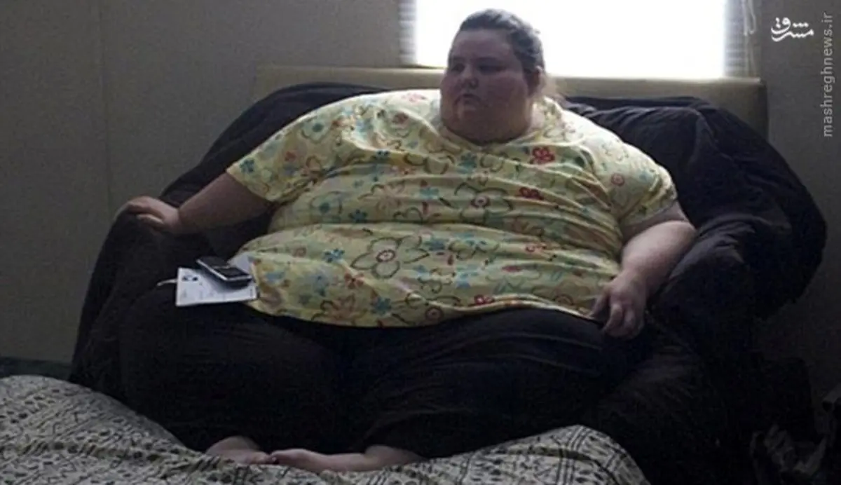 عکس/ دختر 321 کیلوگرمی بعد از عمل